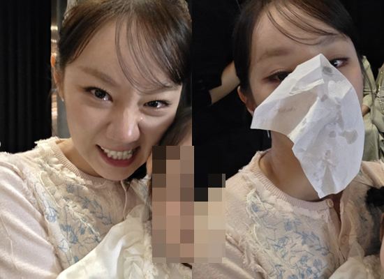 대표 이미지